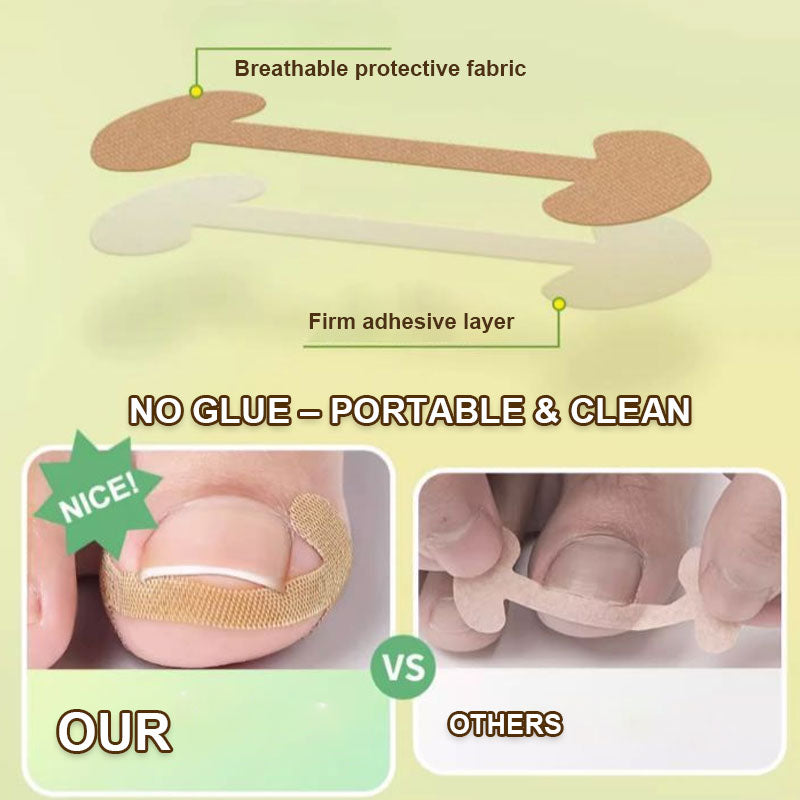 đŠ¶ TĂ„nagelkorrigeringsremsor â Omedelbar lindring och skonsam fixering